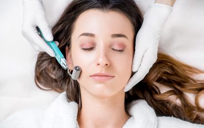 What Do Providers Say About Microneedling With PRF?