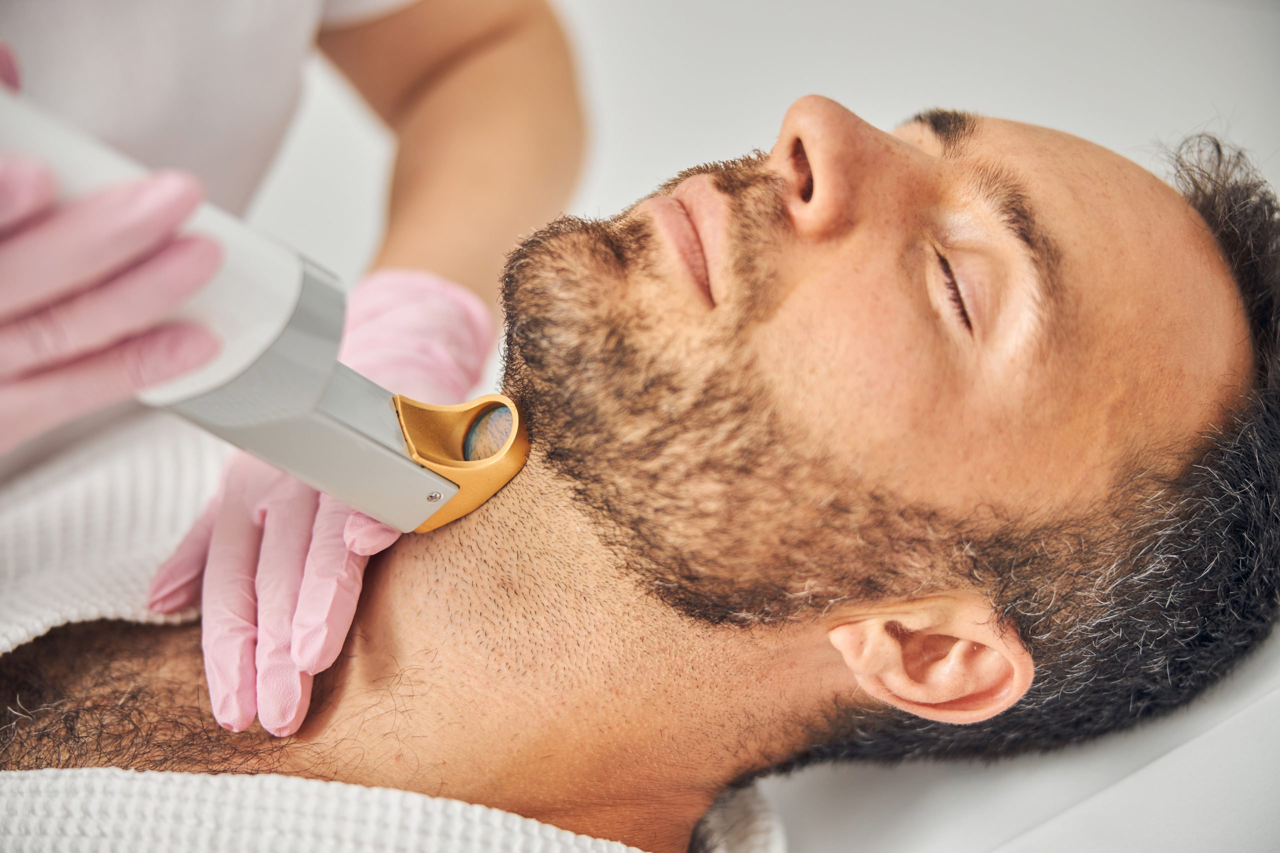 Unleash the Power of Laser Hair Remover